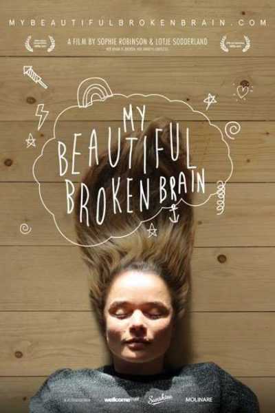 فيلم My Beautiful Broken Brain 2014 مترجم